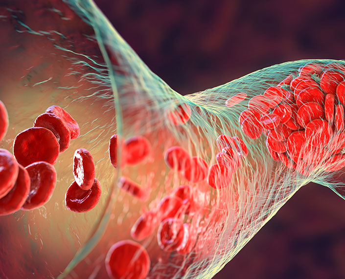 Programa Cuida de tus arterias y controla tu riesgo vascular